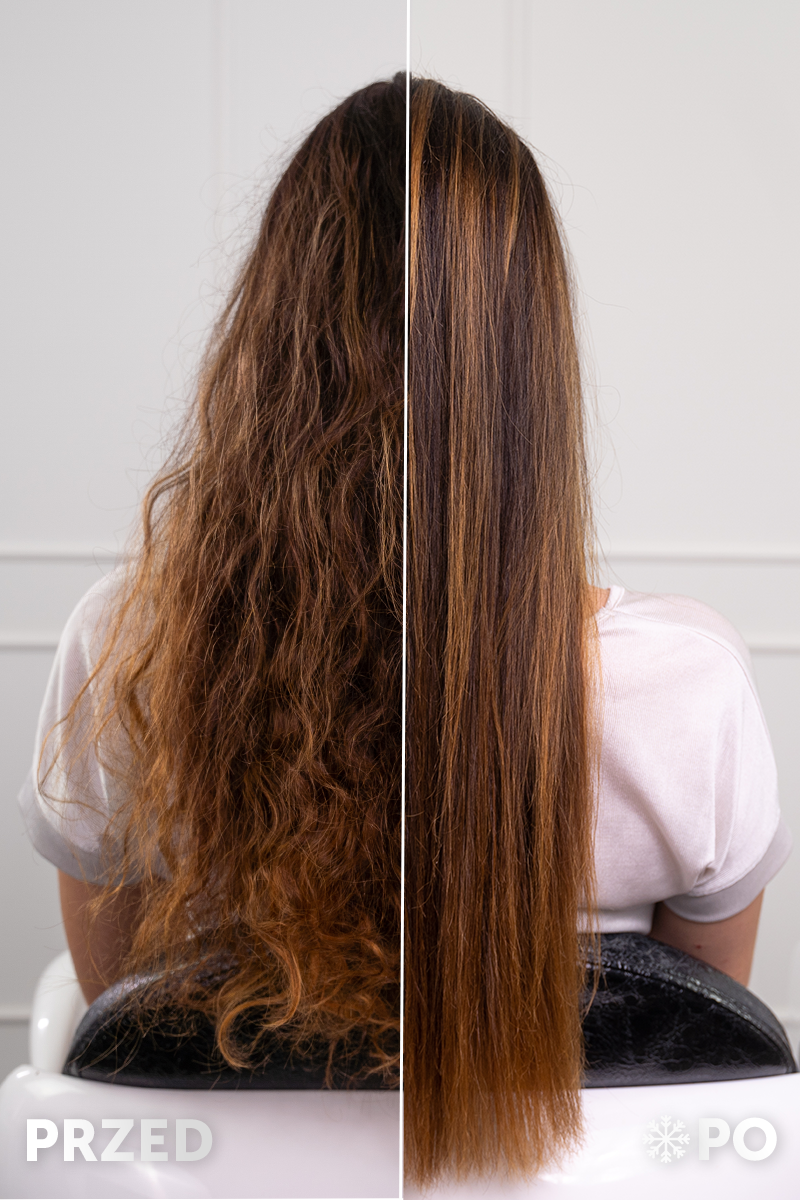 Włosy przed i po zabiegu krioterapii